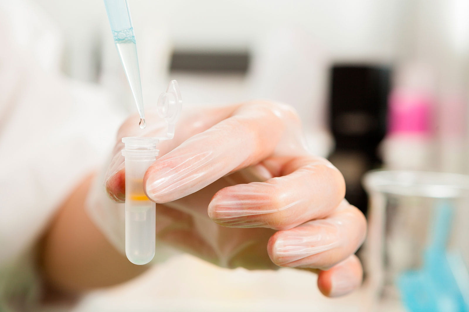 Hand holding a pipet